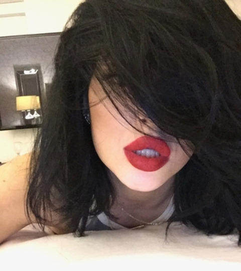gallery_main_Kylie_Jenner_Before_After_Lips_01.jpg
