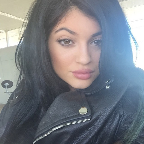 gallery_main_Kylie_Jenner_Before_After_Lips_02.jpg