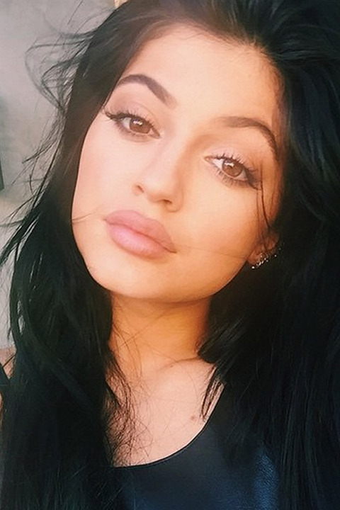 gallery_main_Kylie_Jenner_Lip_Injections_01.jpg