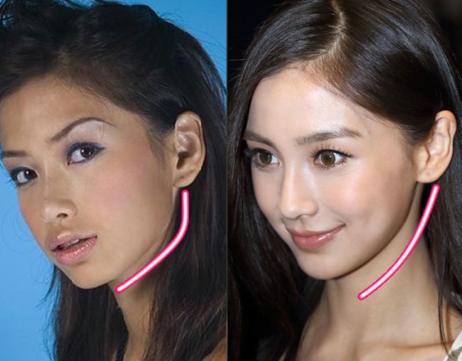 Angelababy_before_and_after_jaw_surgery.jpg