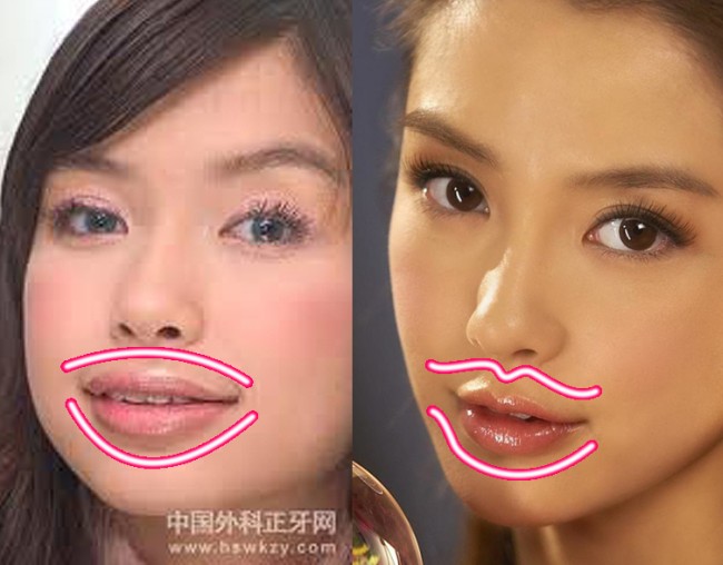 Angelababy_before_and_after_lip_implants.jpg