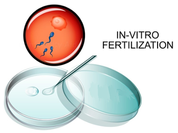 ivf.png