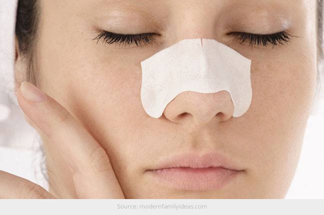 blackheads1.jpg